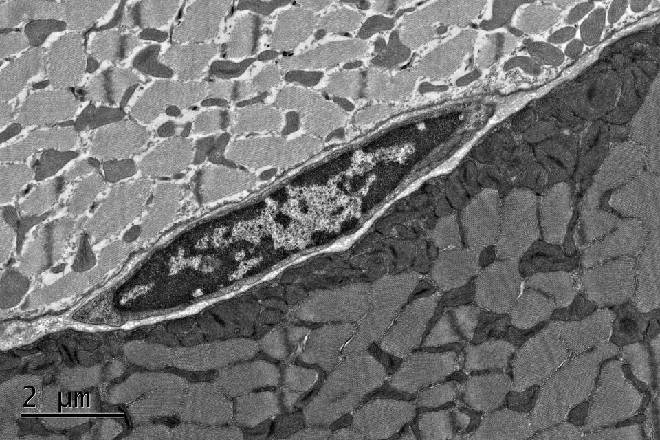 Stem cell quiescence