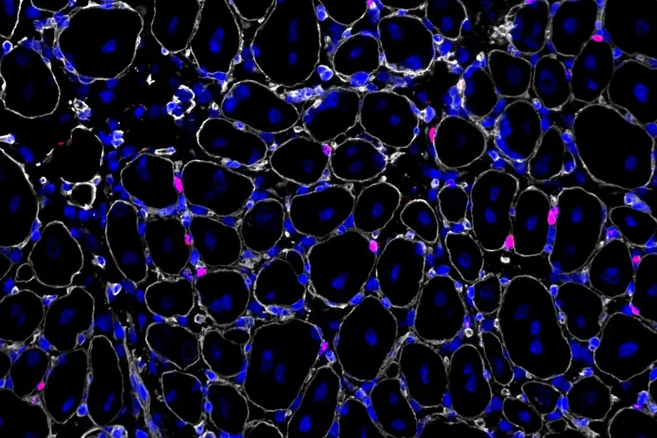 stem cells in muscle regeneration