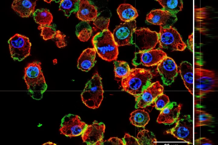 Tissue engineering